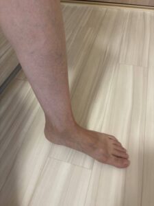 リタライフによる足湯体験　ビフォアー