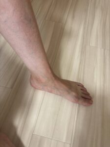 リタライフによる足湯体験　アフター